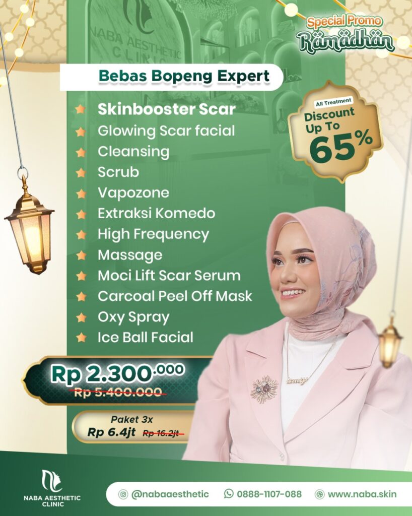 promo ramadhan bebas bopeng expert