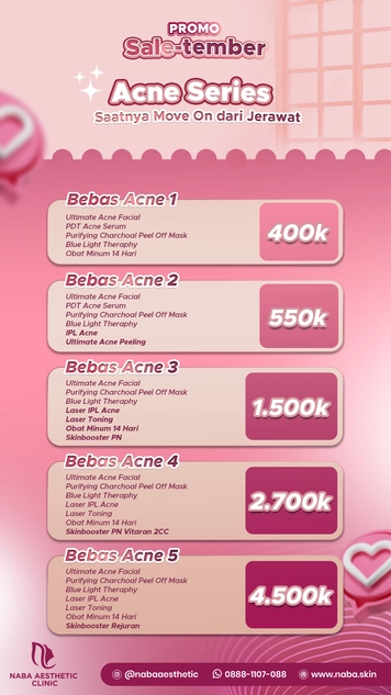 Promo Sale-tember Naba Aesthetic Clinic – Paket Acne Series Mulai 400K untuk Perawatan Jerawat